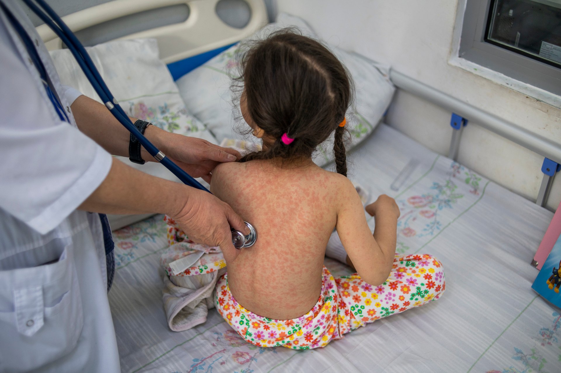 Measles-rubella cases rise by 35%, fueled by unvaccinated kids

