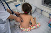 Measles-rubella cases rise by 35%, fueled by unvaccinated kids