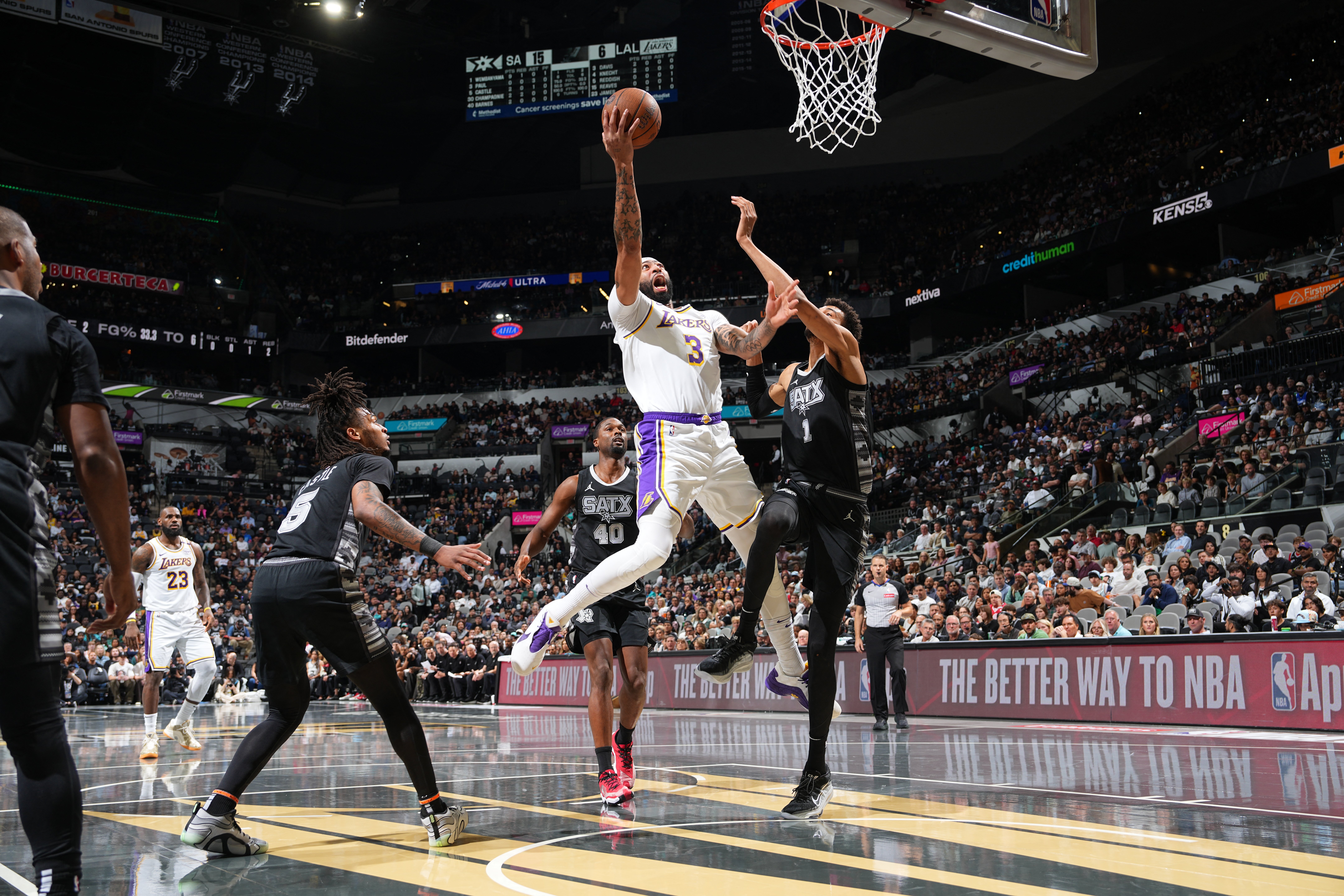 Davis tows Lakers past Spurs