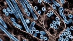 U.S. reports first bird-flu case in a child
