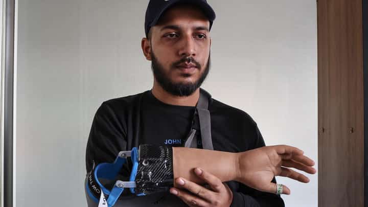 Bangladeshi students who lost their hands during protests to overthrow the government in August have been fitted with robotic replacements
