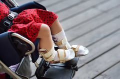 Cerebral palsy patients get huge boost