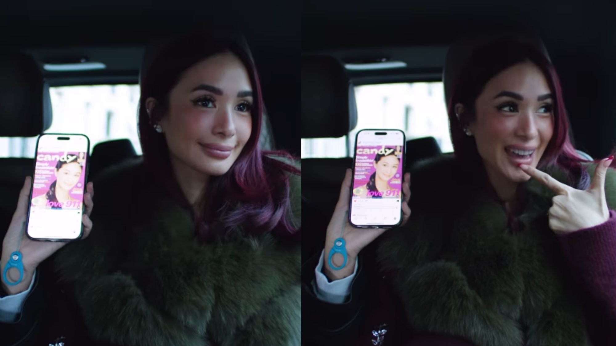Heart Evangelista denies plastic surgery, admits to lip enhancement