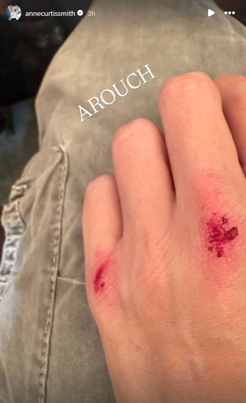 Anne Curtis Instagram