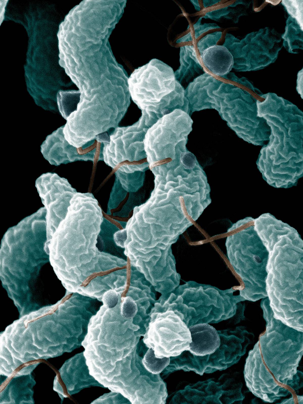 Campylobacter bacteria are the number one cause of bacterial food-related gastrointestinal illness in the United States. To learn more about this pathogen, ARS scientists are sequencing multiple Campylobacter genomes. This scanning electron microscope image shows the characteristic spiral, or corkscrew, shape of C. jejuni cells and related structures.