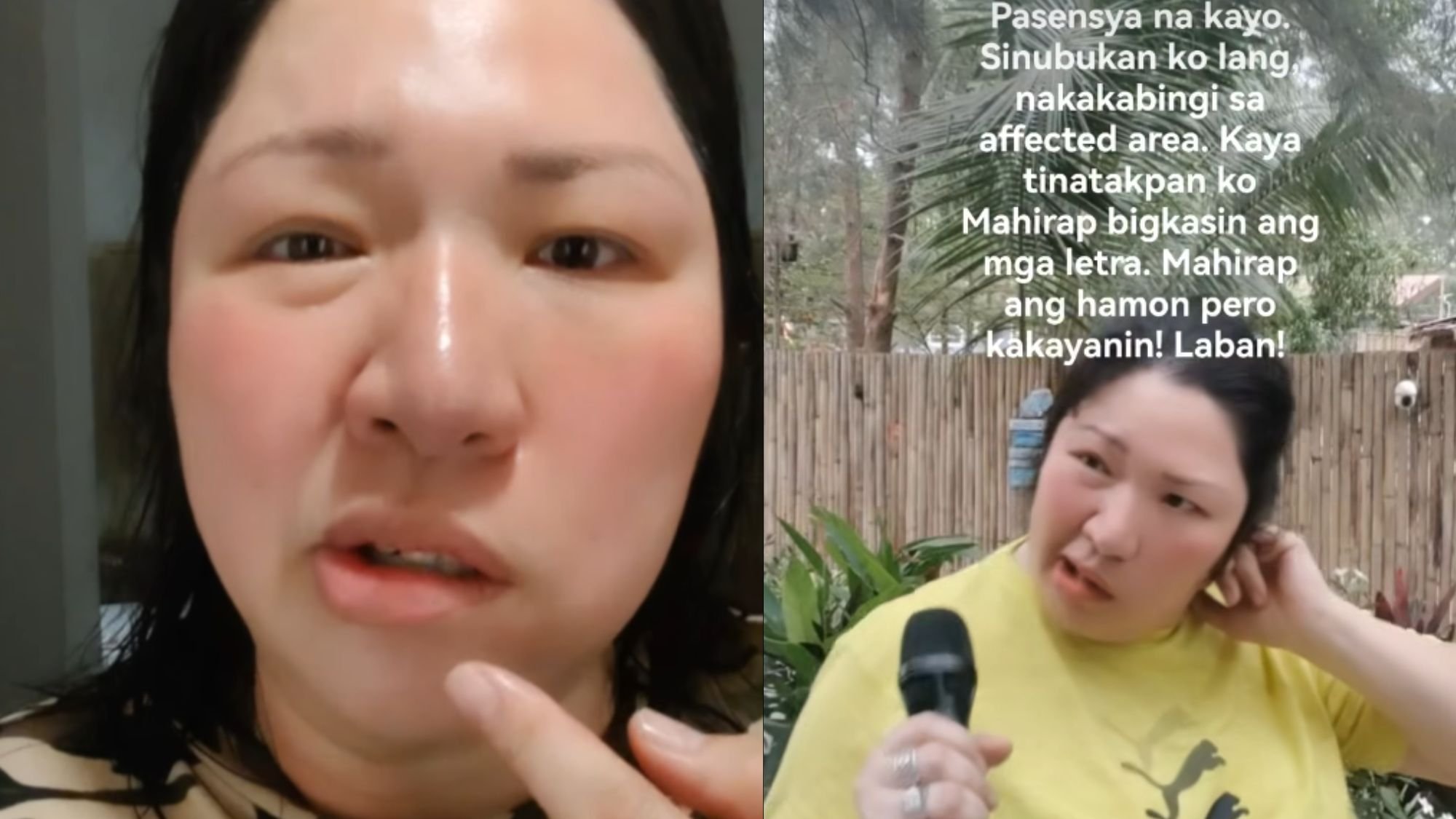 Frenchie Dy opens up about battling Bell’s Palsy