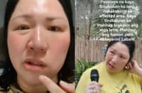 Frenchie Dy shares her struggle with Bell's Palsy for the third time