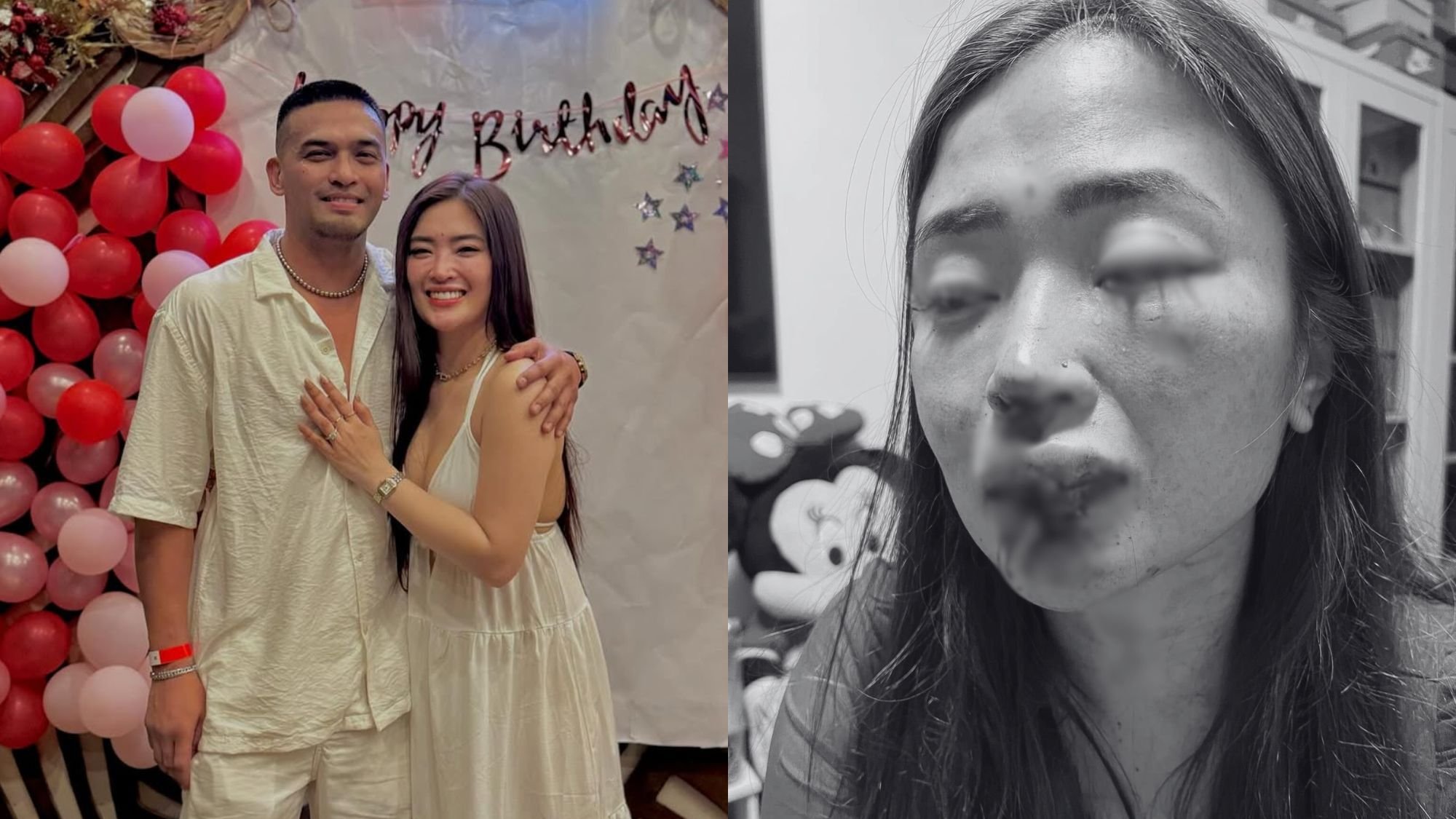Jam Ignacio, Karla Estrada’s ex, face abuse allegations from fiancée 