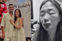 Jam Ignacio, Karla Estrada’s ex, face abuse allegations from fiancée