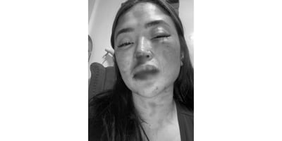 Women's rights advocate condemns violence vs. DJ Jellie Aw
