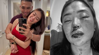 Jam Ignacio still wants to 'wed' Jellie Aw despite assault claims