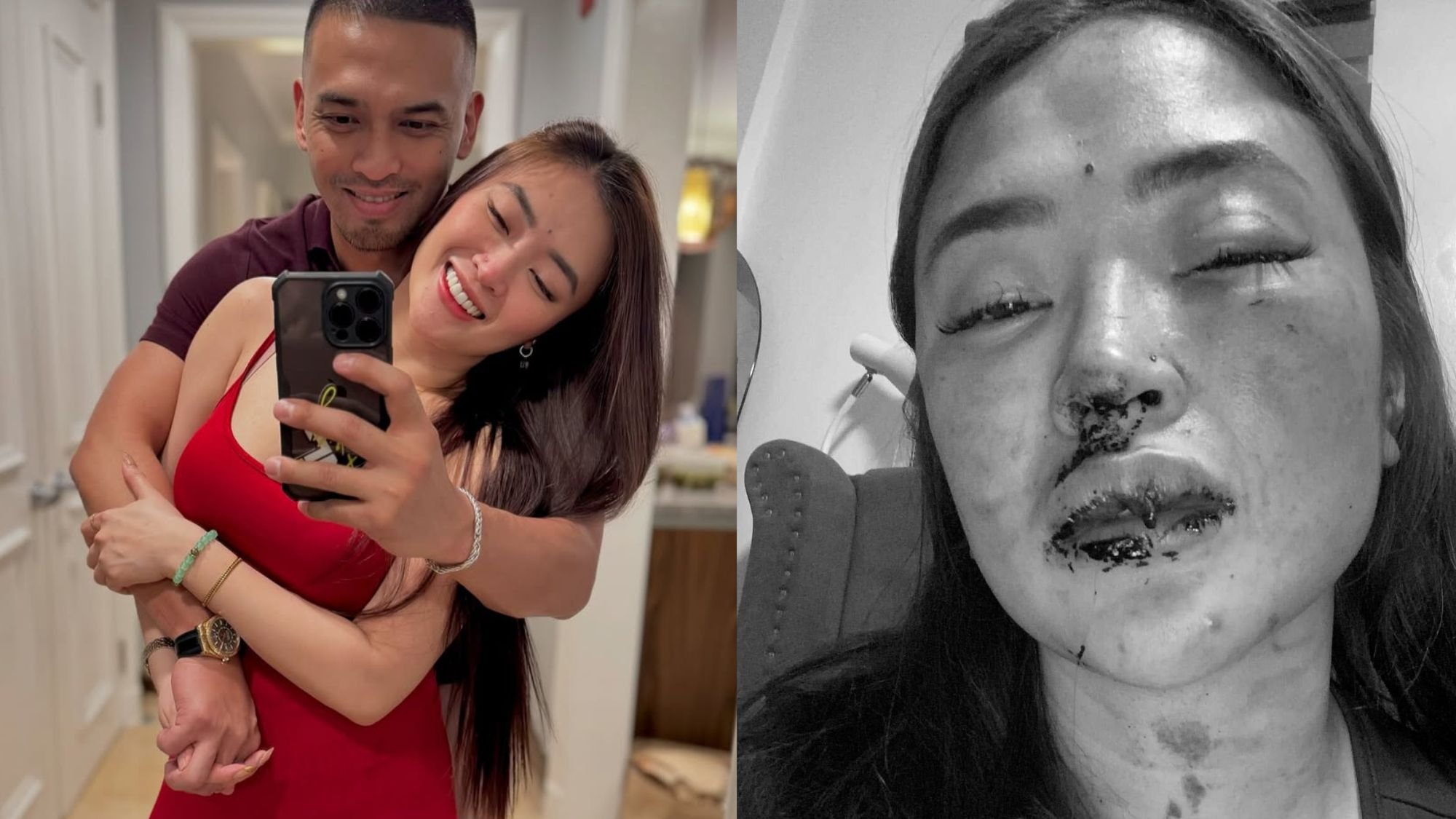 Jam Ignacio still wants to 'wed' Jellie Aw despite assault claims