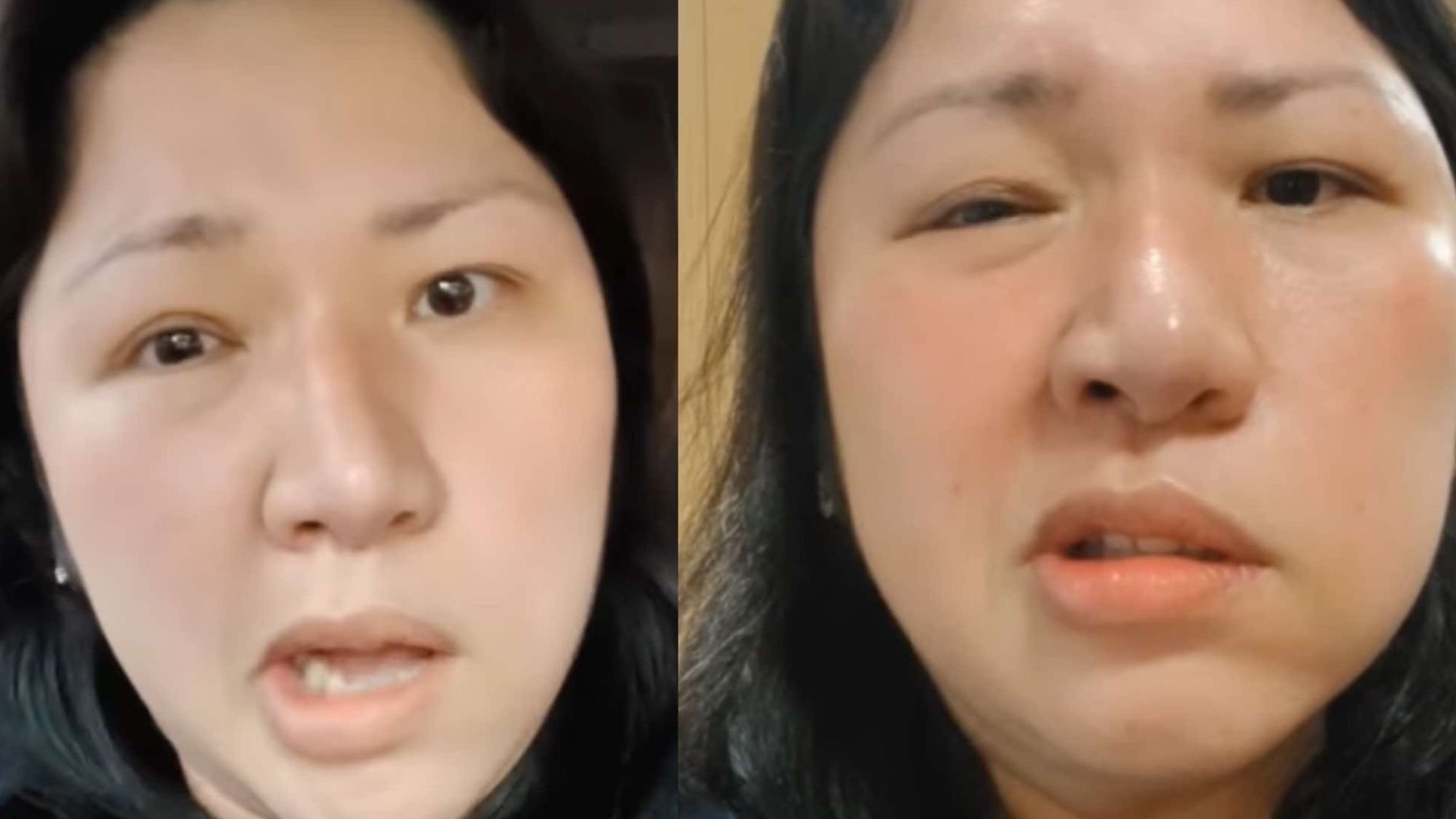 Frenchie Dy shares health update amid third battle with Bell’s Palsy
