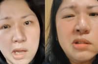 Frenchie Dy shares encouraging health update amid third battle with Bell’s Palsy.