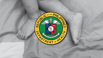 DOH logs 2,525 new hand, foot, and mouth disease cases in one week