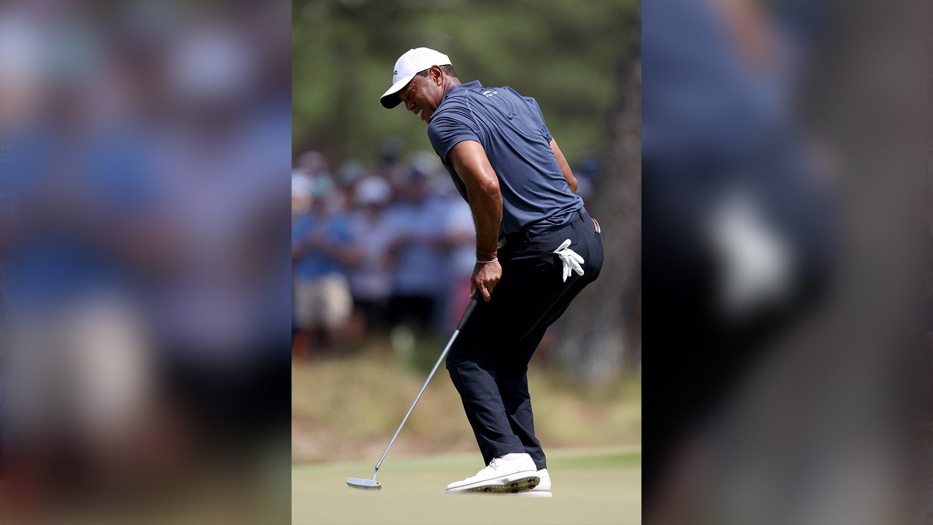 Woods undergoes Achilles tendon surgery