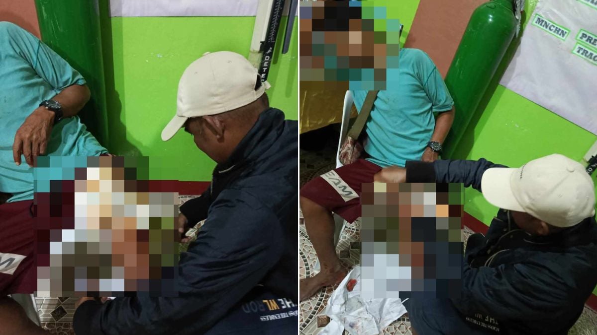 Resident survives croc attack in Palawan