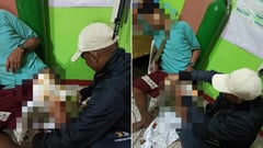 Resident survives croc attack in Palawan