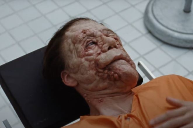 Born with neurofibromatosis, Edward’s severely disfigured face causes him to retreat into himself.
