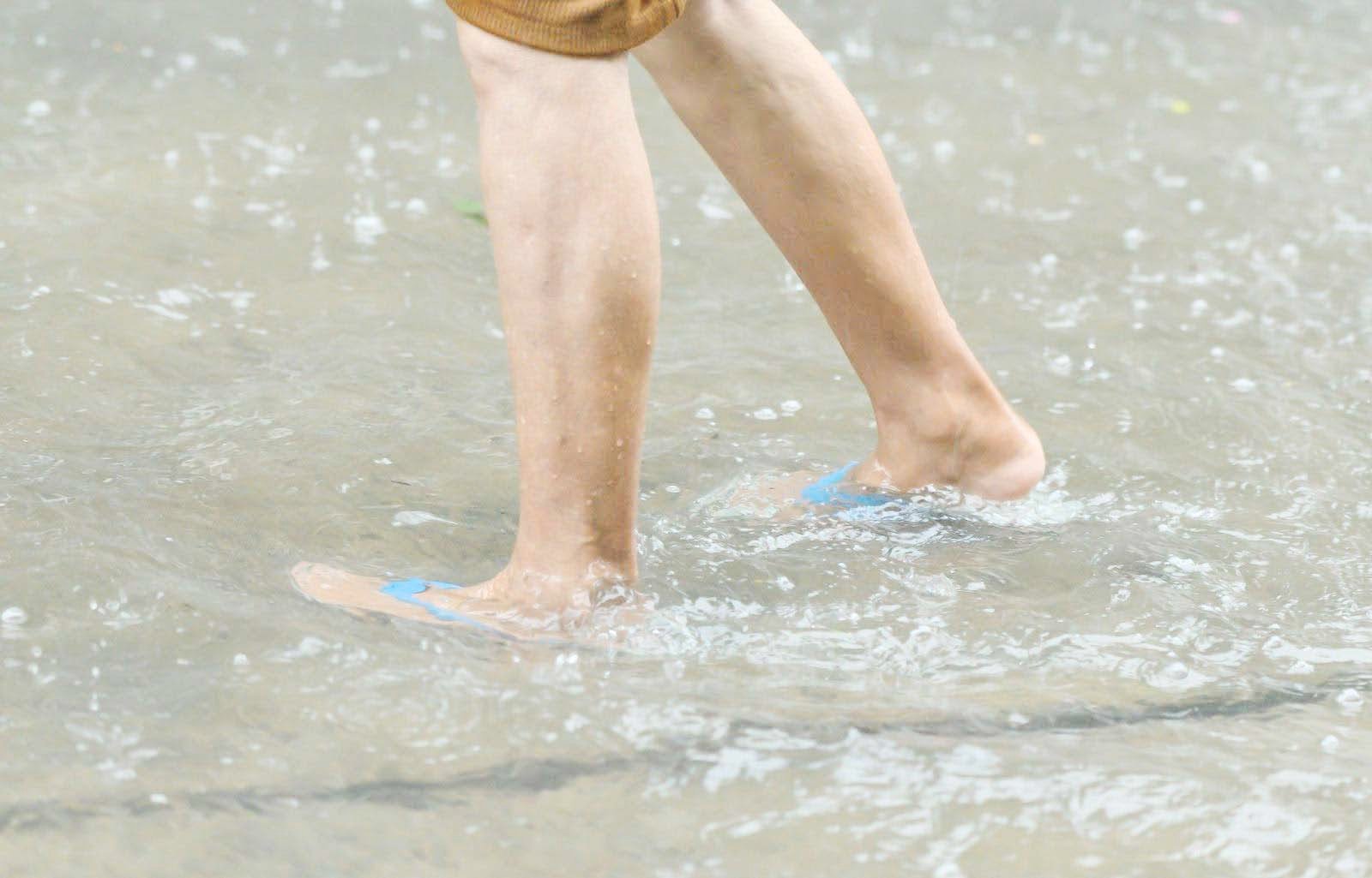 DOH on alert as leptospirosis cases top 500 after floods