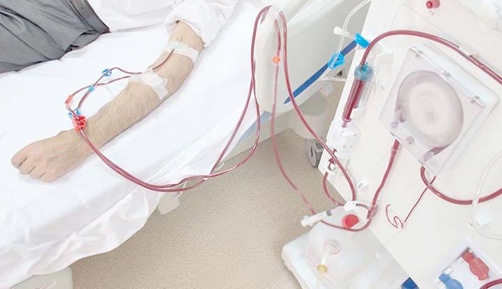 Dialysis, Diet Coke and Dedication: Celebrating Dr. Raymond Alonso Alonso