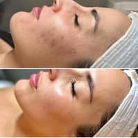 Hollywood celebs’ beauty secret now
in the Philippines