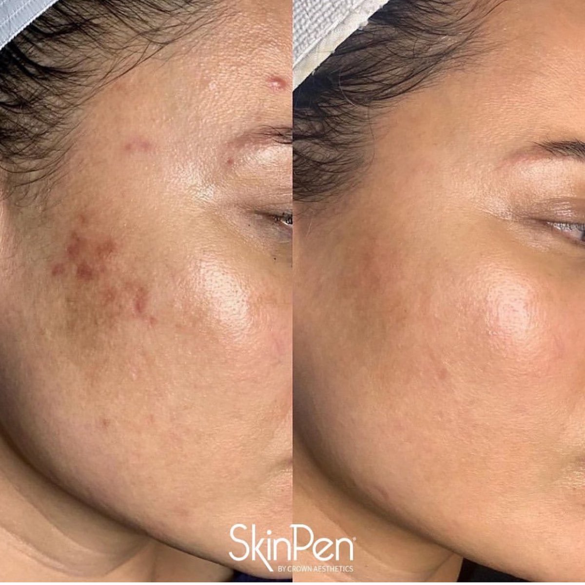 Visible results.