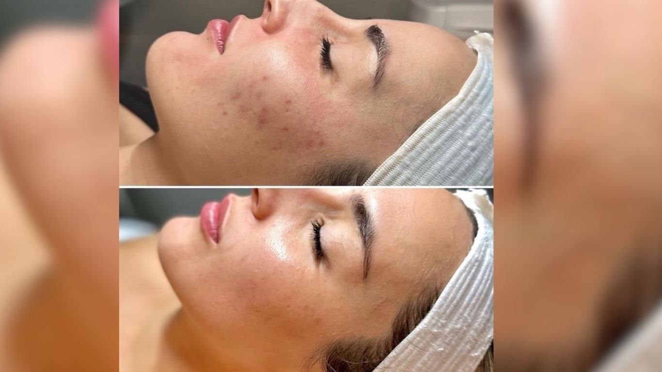 Hollywood celebs’ beauty secret now in the Philippines