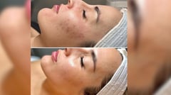 Hollywood celebs’ beauty secret now in the Philippines