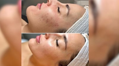 Hollywood celebs’ beauty secret now in the Philippines