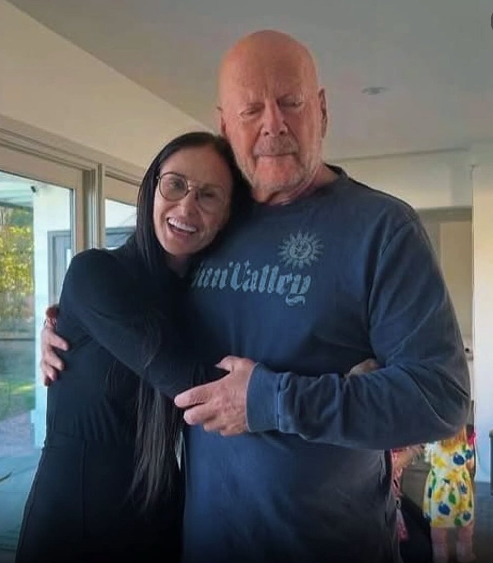 Bruce Willis' quiet battle with frontotemporal dementia