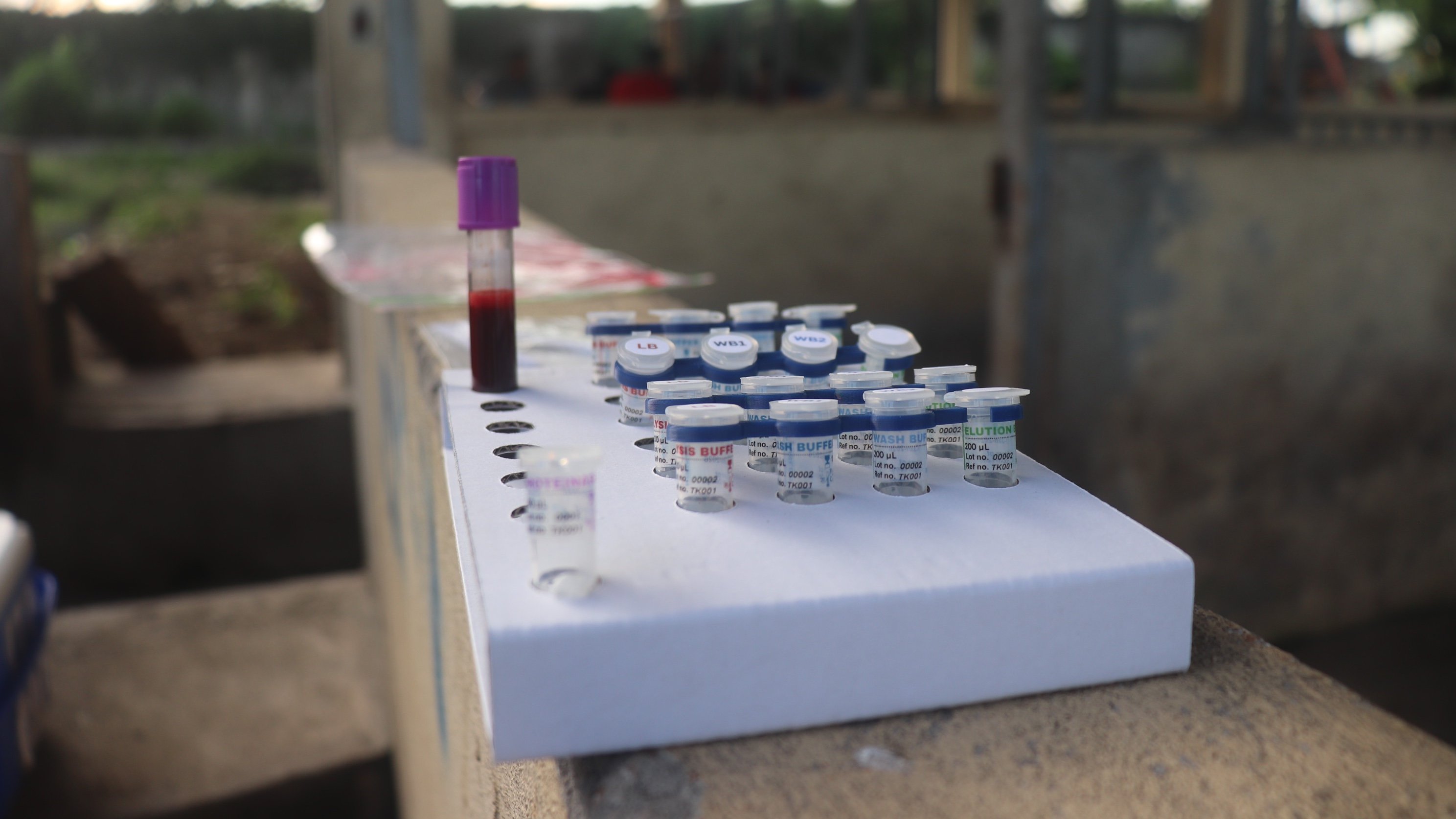 Pinoy diagnostic tools, mobile lab boost fight vs African Swine Fever