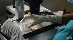 Couple welcomes world's 'oldest baby' from 30-year-old frozen embryo