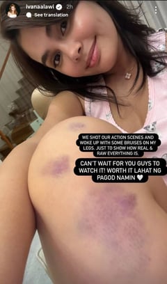 Ivana Alawi wears her battle scars with pride