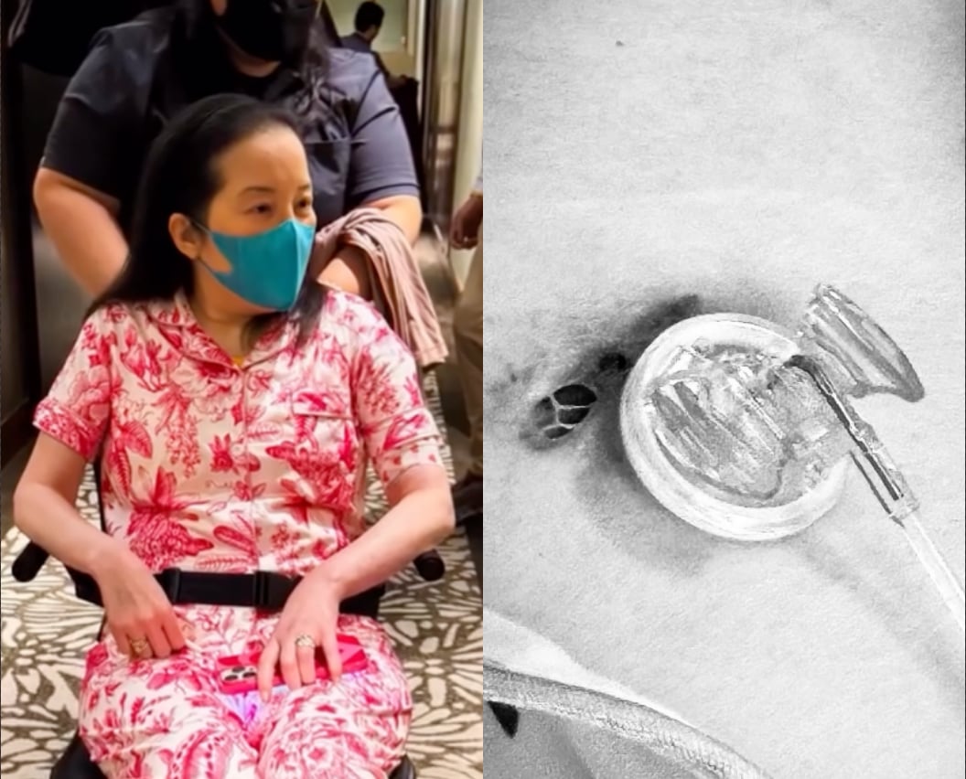 Kris Aquino to undergo surgery, thankful for 'sharp survival instincts'