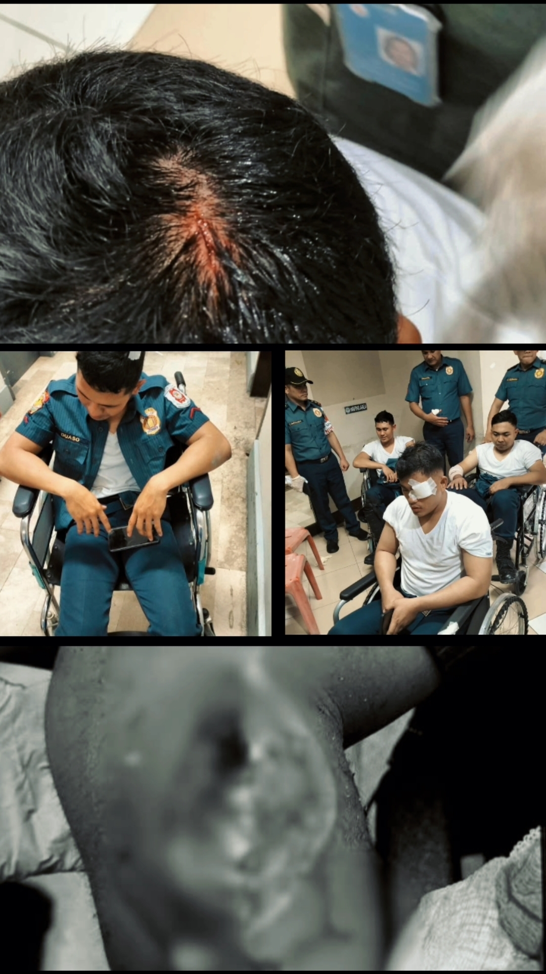 10 PRO3 officers injured amid violent Mendiola protests