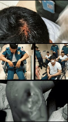 10 PRO3 officers injured amid violent Mendiola protests
