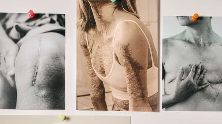 The Scar Project honors scars as stories of strength, healing and resilience.