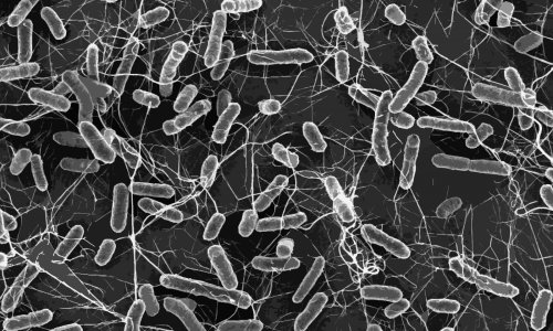 Spread of drug-resistant superbugs surging