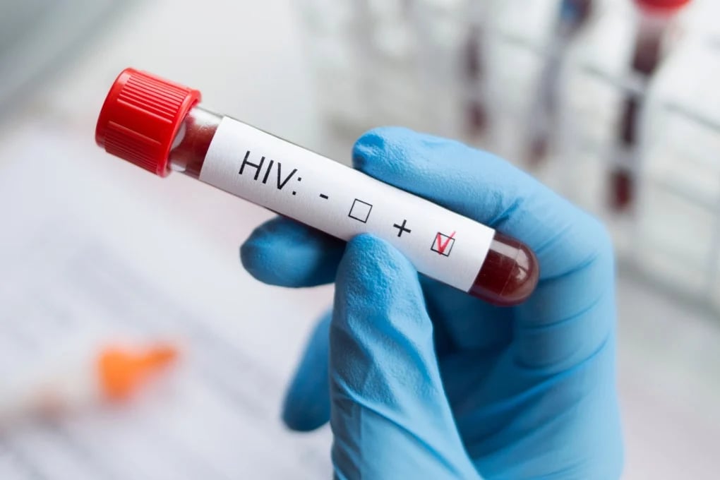 Cebu faces HIV cases surge among youths