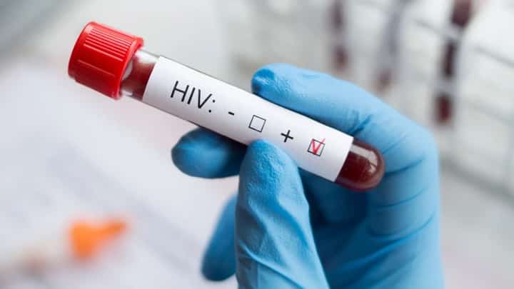 Cebu faces HIV cases surge among youths