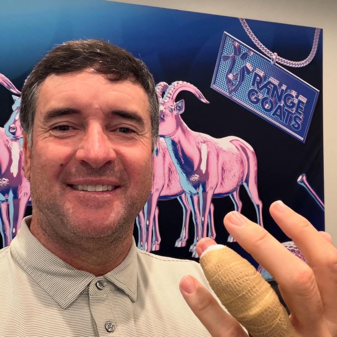 BUBBA Watson shows his injured finger that sidelines him in the International Series Philippines presented by BingoPlus at the Sta. Elena Golf and Country Club in Laguna.