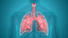 Pneumonia among top killers in the Philippines