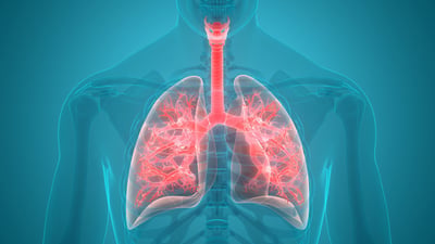 Pneumonia 4th top Phl killer; immunization drive strengthened
