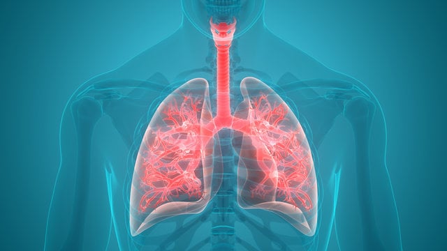 Pneumonia among top killers in the Philippines