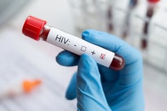Capiz health officials alarmed over spiking HIV infections