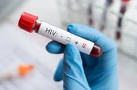 Capiz health officials alarmed over spiking HIV infections