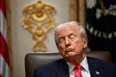 Trump LINKS bruised hand on aspirin, denies falling asleep