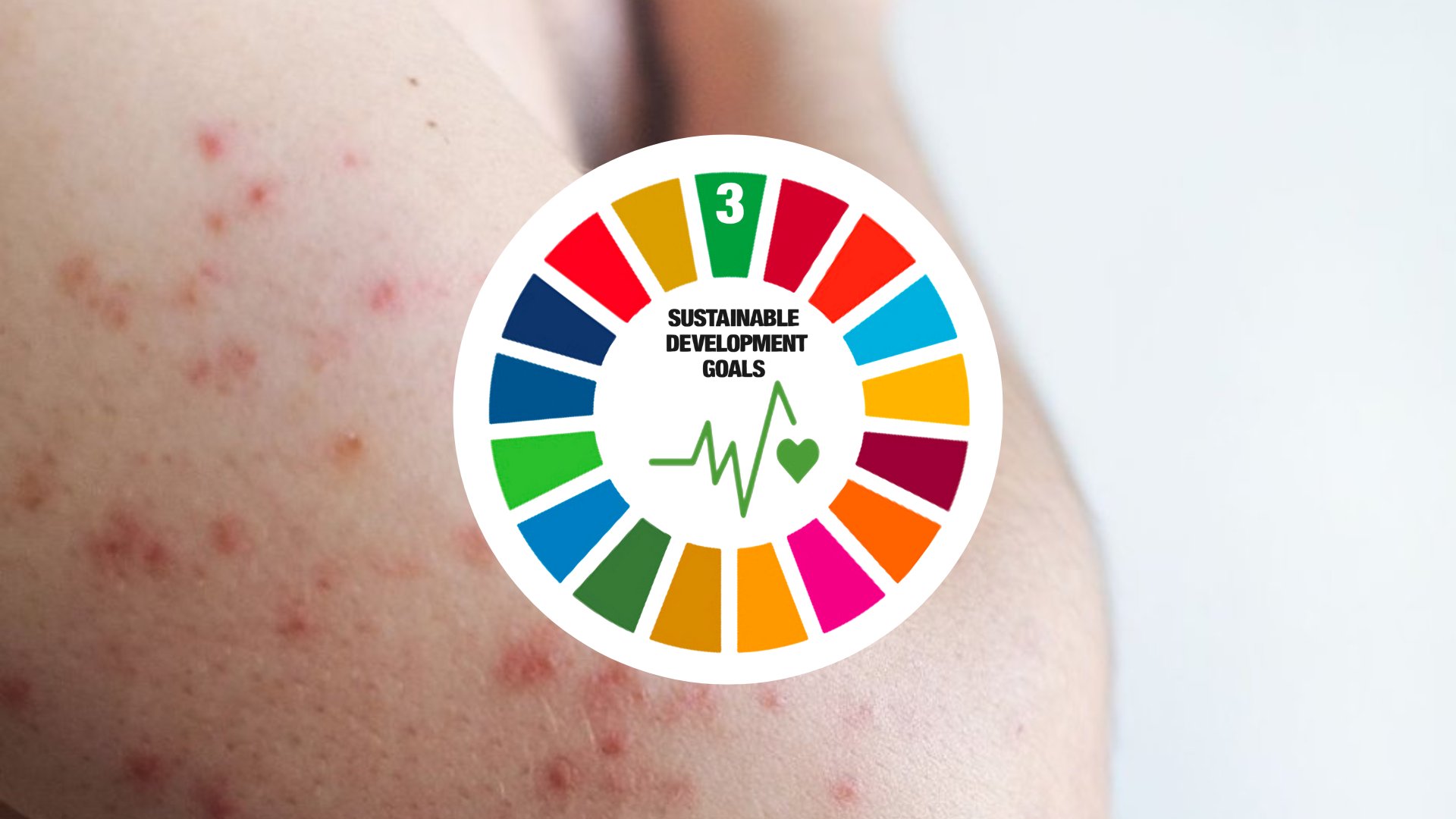 DoH-XI holds measles-rubella vax activity