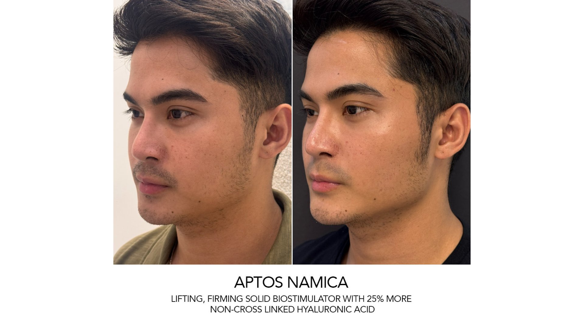 Male treatments a rising segment in aesthetic medicine